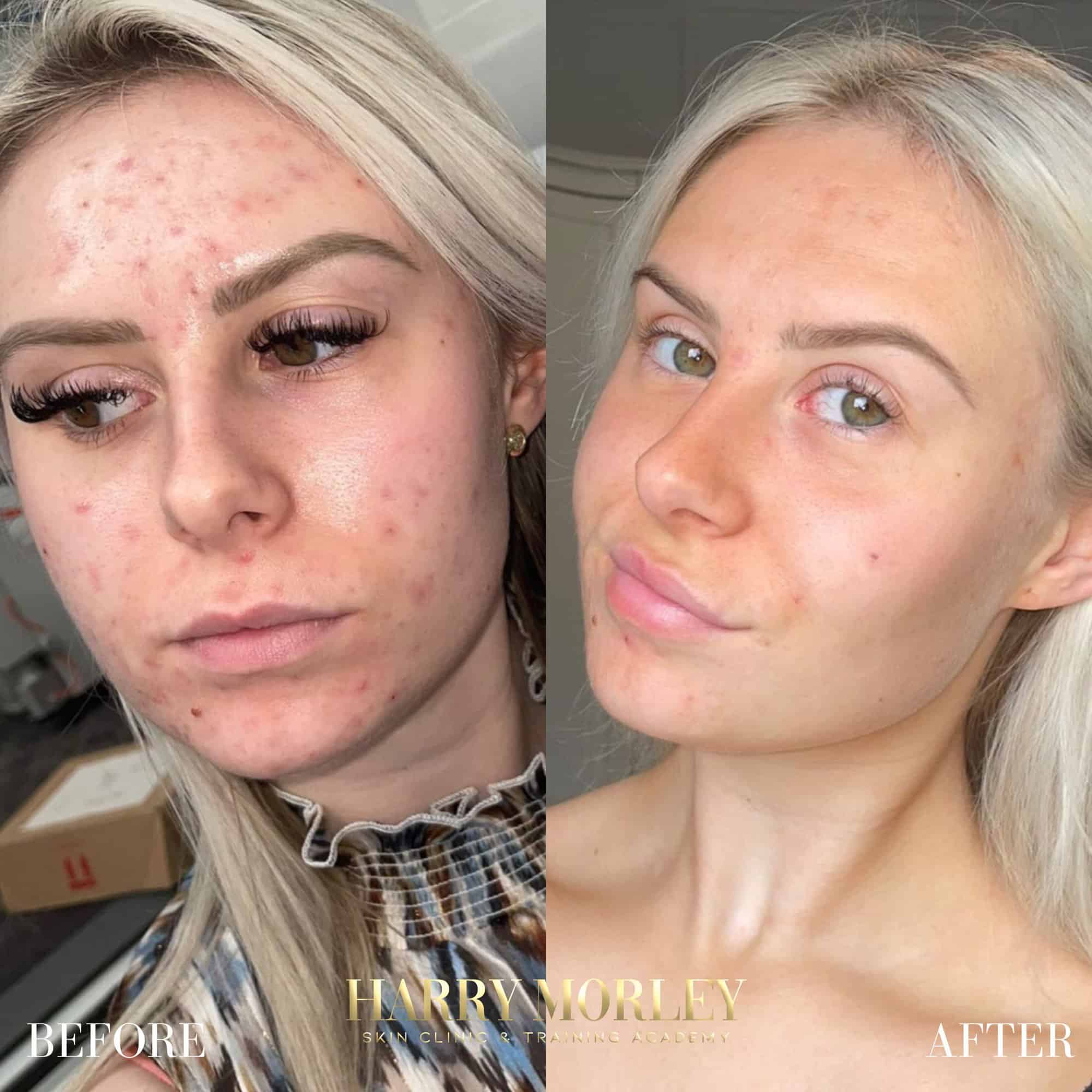 Amazing Skin Care Results