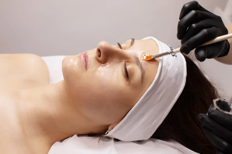 pigmentation peel hero