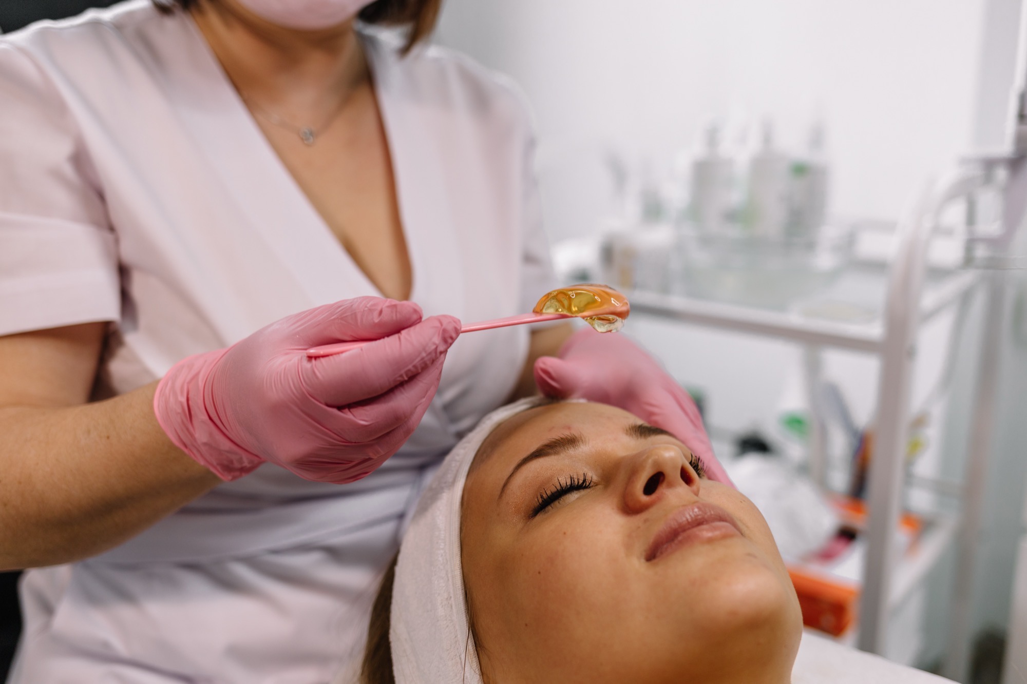 TCA Peel 1 Practitioner applying a chemical peel to a woman's face in a skin clinic